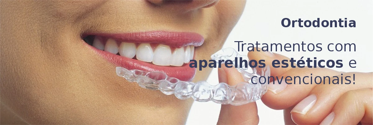 Ortodontia: Tratamentos com aparelhos estéticos (cerâmicos e Invisalign) e convencionais!
