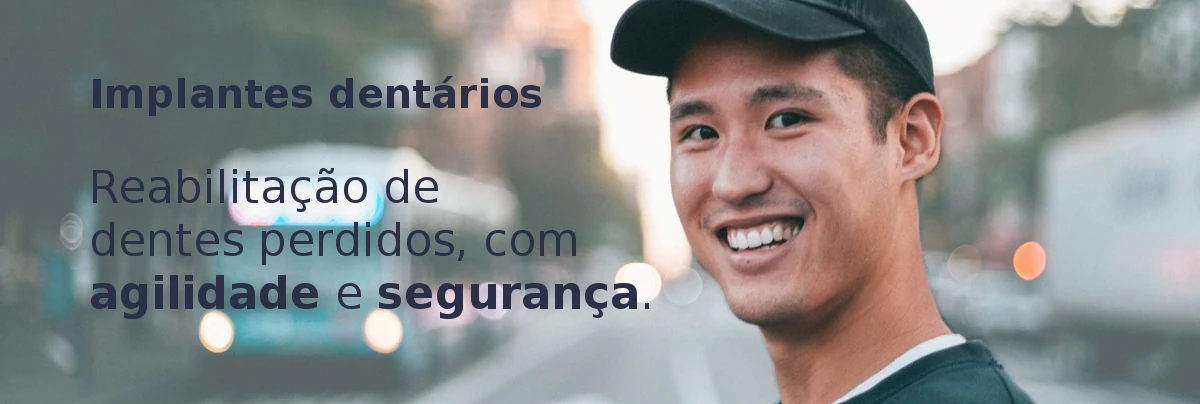 Implantes dentários: Reabilitação de dentes perdidos com segurança e agilidade.